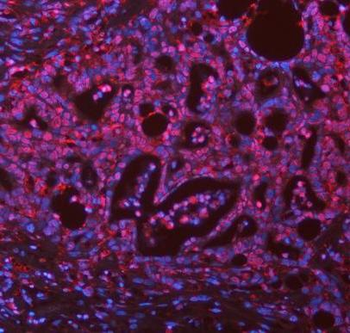 Anti-ASC/TMS1/PYCARD Antibody