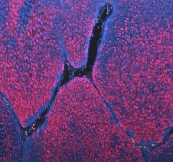 Anti-ASC/TMS1/PYCARD Antibody