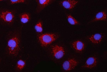 Anti-ASC/TMS1/PYCARD Antibody
