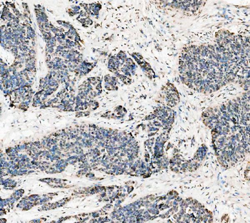 Anti-ASC/TMS1/PYCARD Antibody