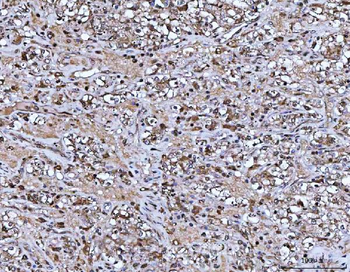 Anti-ASC/TMS1/PYCARD Antibody