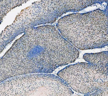 Anti-ASC/TMS1/PYCARD Antibody
