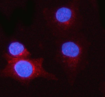 Anti-PSME1 Antibody