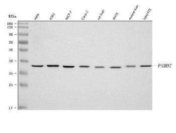 Anti-PSMD7 Antibody