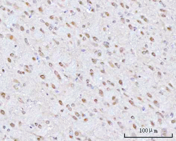 Anti-PSMD4 Antibody