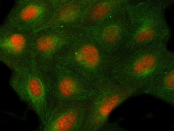 Anti-PSMD4 Antibody