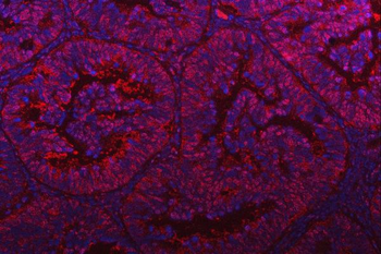 Anti-PSMD4 Antibody