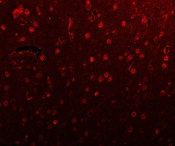 Anti-PSMD4 Antibody