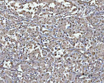 Anti-PSMD4 Antibody
