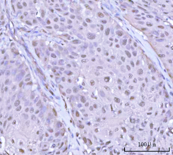 Anti-PSMD4 Antibody