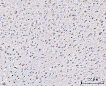 Anti-PSMD4 Antibody