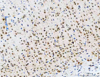 Anti-POH1/PSMD14 Antibody
