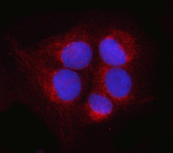 Anti-POH1/PSMD14 Antibody