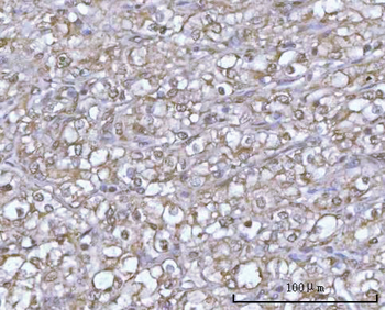 Anti-POH1/PSMD14 Antibody