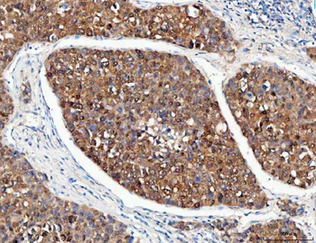 Anti-POH1/PSMD14 Antibody