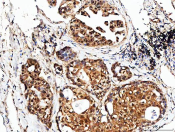 Anti-POH1/PSMD14 Antibody
