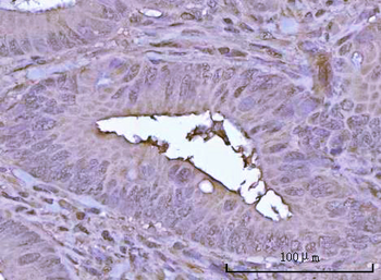 Anti-POH1/PSMD14 Antibody