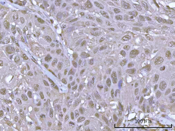 Anti-POH1/PSMD14 Antibody