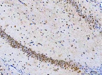 Anti-POH1/PSMD14 Antibody