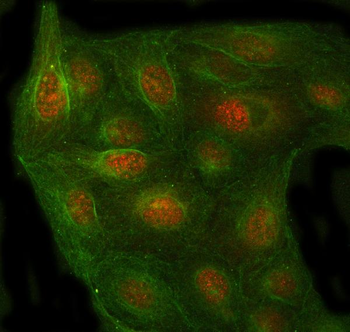 Anti-PSMC4 Antibody