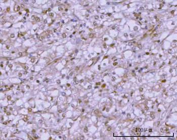 Anti-PSMC4 Antibody