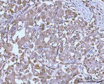 Anti-PSMC4 Antibody