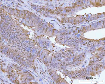 Anti-PSMC4 Antibody