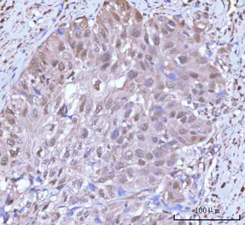 Anti-PSMC4 Antibody