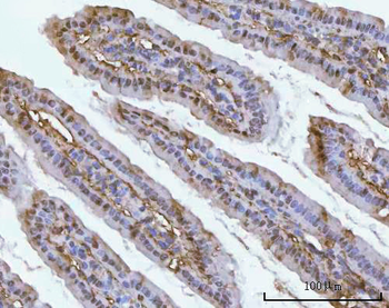 Anti-PSMC4 Antibody