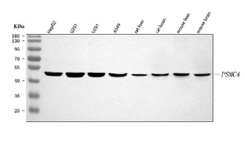 Anti-PSMC4 Antibody