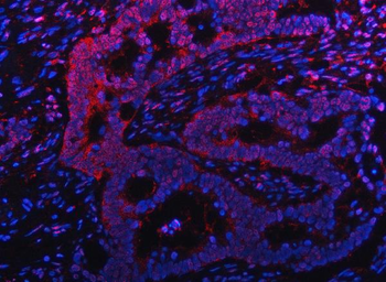 Anti-PSMB9 Antibody