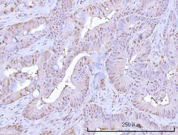 Anti-PSMB9 Antibody