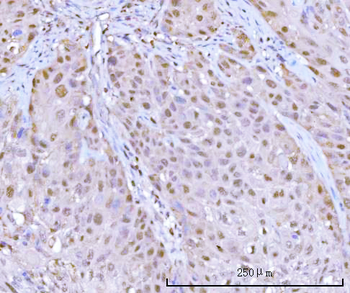 Anti-PSMB9 Antibody