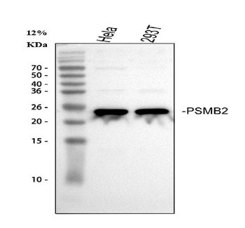 Anti-PSMB2 Antibody