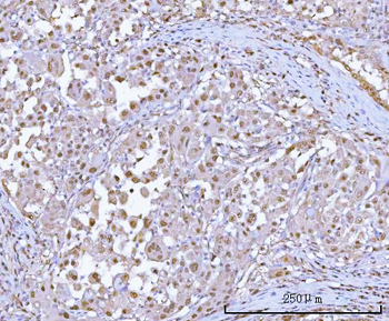Anti-PSMA1 Antibody