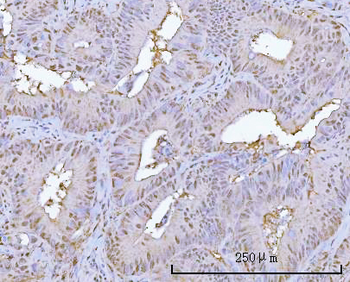 Anti-PSMA1 Antibody