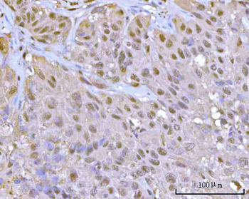 Anti-PSMA1 Antibody