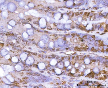 Anti-PSMA1 Antibody