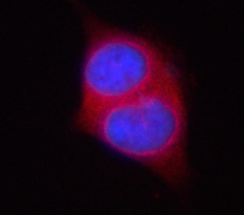 Anti-PSAT1 Antibody