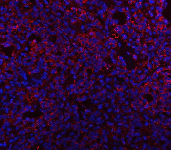 Anti-PSAP Antibody