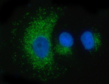Anti-PSAP Antibody