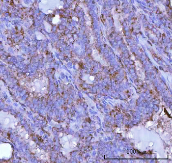 Anti-PSAP Antibody