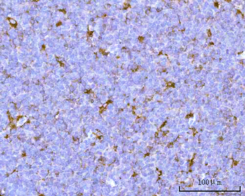 Anti-PSAP Antibody