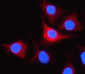 PRSS44 Rabbit Polyclonal Antibody