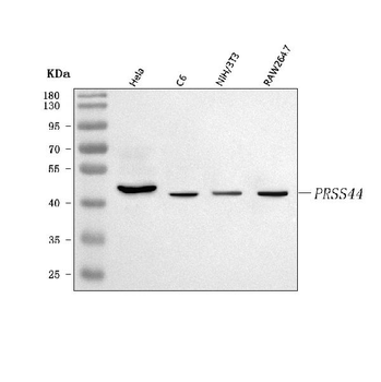 PRSS44 Rabbit Polyclonal Antibody