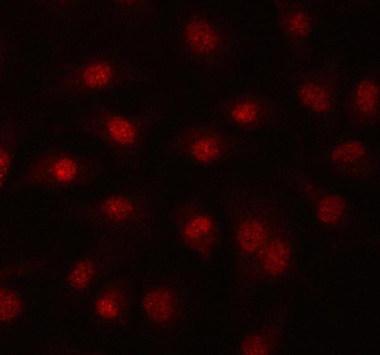 Anti-PRPF39 Antibody