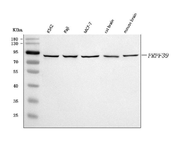 Anti-PRPF39 Antibody