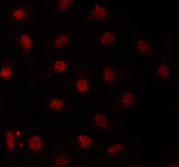 Anti-PRPF31 Antibody