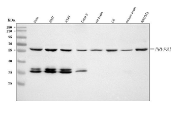Anti-PRPF31 Antibody