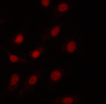 Anti-PRPF18 Antibody